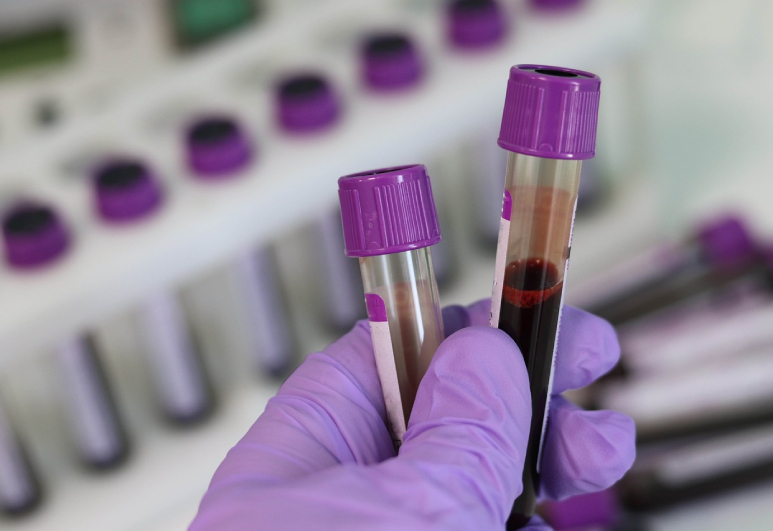 laboratory-3827736_1280 (1)